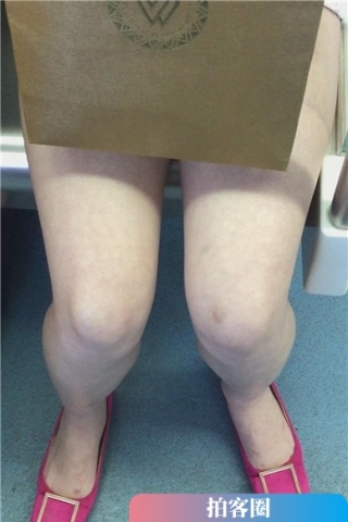 低头玩手机入迷的美女，腿腿真白（视频版）